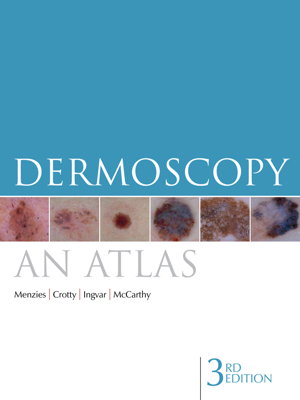 Cover art for Dermoscopy An Atlas 3rd Edition