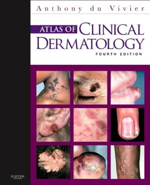Cover art for Atlas of Clinical Dermatology