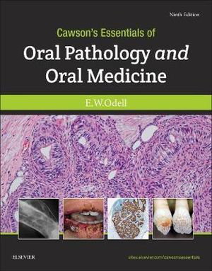 Cover art for Cawson's Essentials of Oral Pathology and Oral Medicine