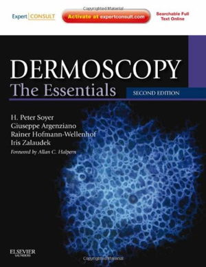 Cover art for Dermoscopy