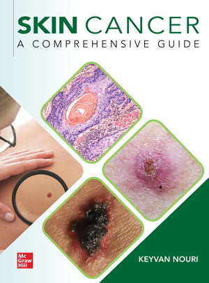 Cover art for Skin Cancer: A Comprehensive Guide