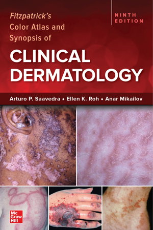 Cover art for Fitzpatrick's Color Atlas and Synopsis of Clinical Dermatology, Ninth Edition