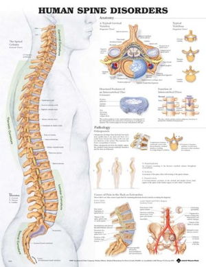 Cover art for Human Spine Disorders Anatomical Chart