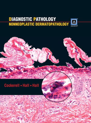 Cover art for Diagnostic Pathology Nonneoplastic Dermatopathology