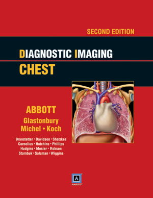 Cover art for Diagnostic Imaging: Chest