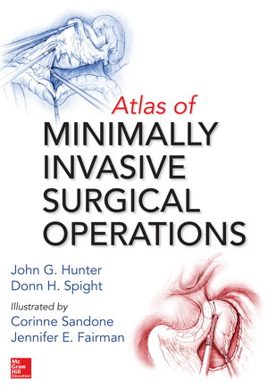 Cover art for Atlas of Minimally Invasive Surgical Operations