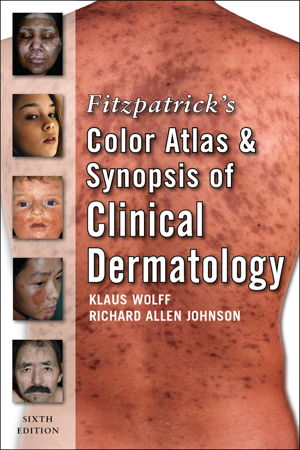 Cover art for Fitzpatrick's Color Atlas and Synopsis of Clinical Dermatology 6th revised edition
