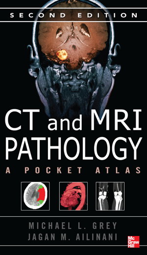 Cover art for CT & MRI Pathology: A Pocket Atlas, Second Edition