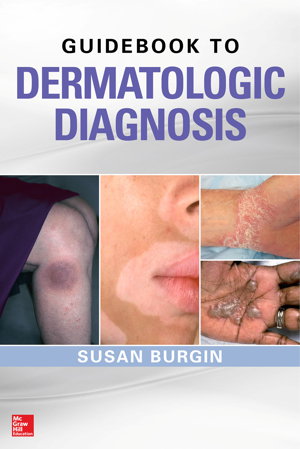 Cover art for Guidebook to Dermatologic Diagnosis