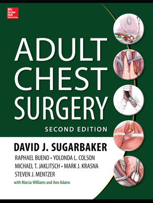 Cover art for Adult Chest Surgery