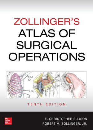 Cover art for Zollinger's Atlas of Surgical Operations, Tenth Edition