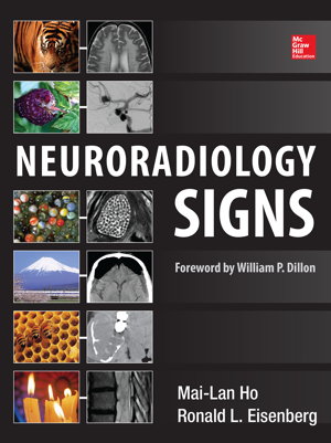Cover art for Neuroradiology Signs