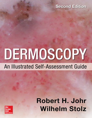 Cover art for Dermoscopy An Illustrated Self-Assessment Guide 2nd edition
