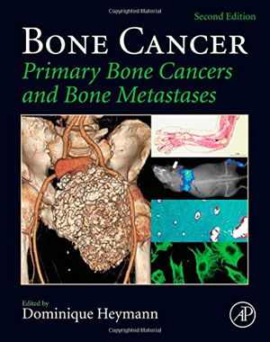 Cover art for Bone Cancer