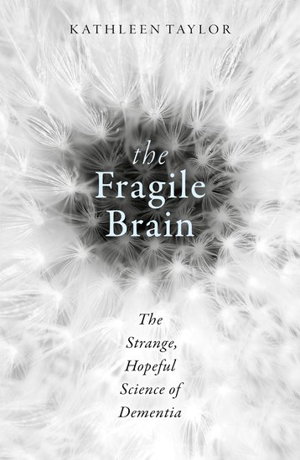 Cover art for The Fragile Brain