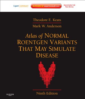 Cover art for Atlas of Normal Roentgen Variants That May Simulate Disease
