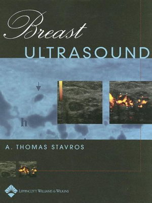 Cover art for Breast Ultrasound