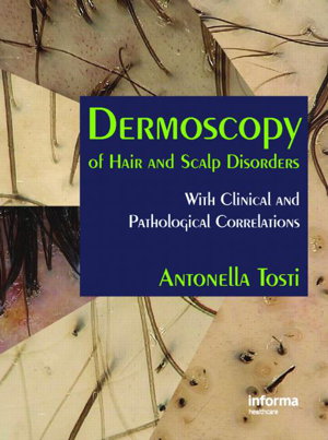 Cover art for Dermoscopy of Hair and Scalp Disorders