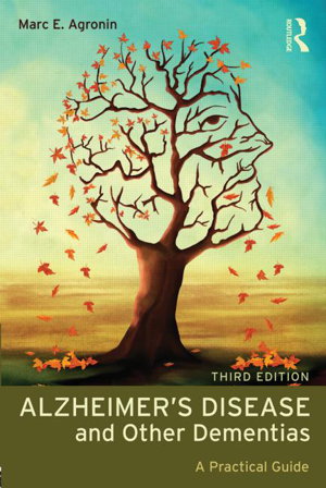 Cover art for Alzheimer's Disease and Other Dementias