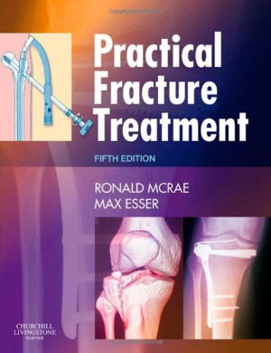 Cover art for Practical Fracture Treatment