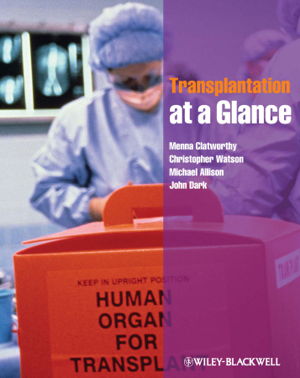 Cover art for Transplantation at a Glance