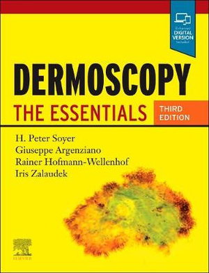 Cover art for Dermoscopy