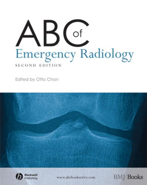Cover art for ABC of Emergency Radiology