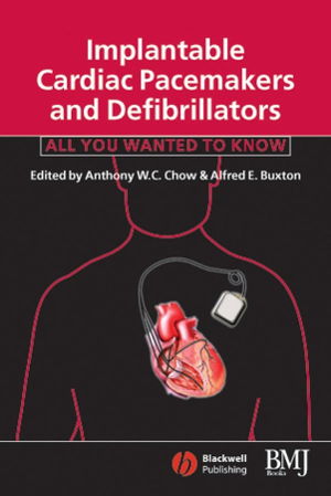 Cover art for Implantable Cardiac Pacemakers and Defibrillators