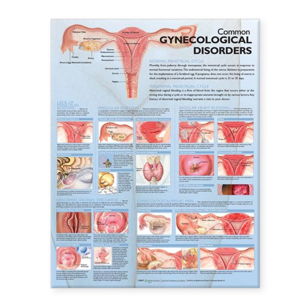 Cover art for Common Gynecological Disorders Anatomical Chart
