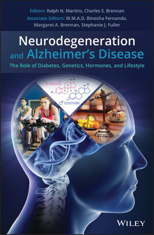 Cover art for Food Composition Diet and Alzheimer's Disease The State of