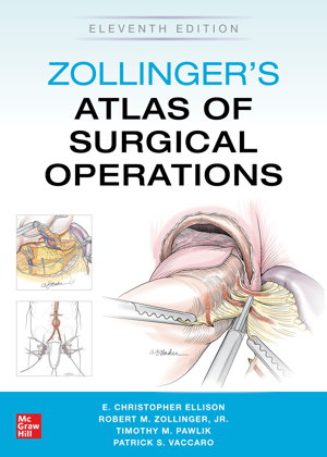 Cover art for Zollinger's Atlas of Surgical Operations, Eleventh Edition