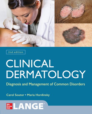 Cover art for Clinical Dermatology: Diagnosis and Management of Common Disorders, Second Edition