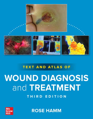 Cover art for Text and Atlas of Wound Diagnosis and Treatment, Third Edition