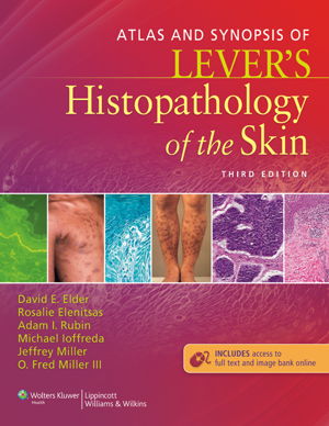 Cover art for Atlas and Synopsis of Lever's Histopathology of the Skin