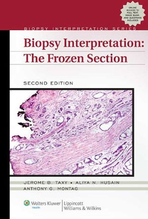 Cover art for Biopsy Interpretation The Frozen Section