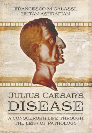 Cover art for Julius Caesar's Disease