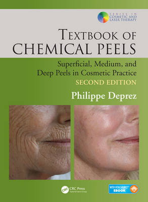 Cover art for Textbook of Chemical Peels Superficial Medium and Deep Peelsin Cosmetic Practice