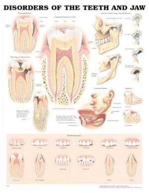 Cover art for Disorders of the Teeth and Jaw Anatomical Chart