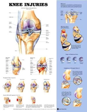Cover art for Knee Injuries Anatomical Chart