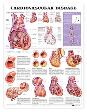 Cover art for Cardiovascular Disease Anatomical Chart