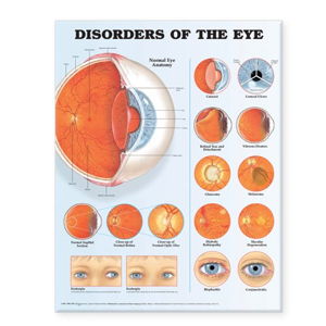 Cover art for Disorders of the Eye Anatomical Chart