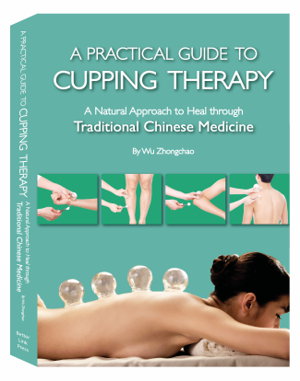 Cover art for A Practical Guide to Cupping Therapy