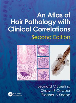 Cover art for An Atlas of Hair Pathology with Clinical Correlations 2nd edition