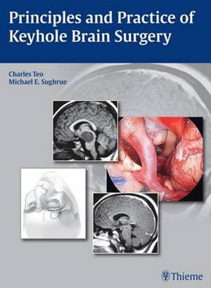 Cover art for Principles and Practice of Keyhole Brain Surgery